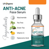 Fights Acne & Pimples with Anti Acne Serum with Niacinamide 30, TeaTree, Vit C -30 ml