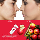 Apple Cider Vinegar Face Wash & Aloe Vera Gel Skin & Hair Care Combo(Pack of 2)