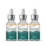 Fights Acne & Pimples with Anti Acne Serum with Niacinamide 30, TeaTree, Vit C -30 ml