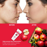 Apple Cider Vinegar Face Wash & Activated Charcoal Peel Off Mask - Skin Care Combo