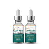 Fights Acne & Pimples with Anti Acne Serum with Niacinamide 30, TeaTree, Vit C -30 ml